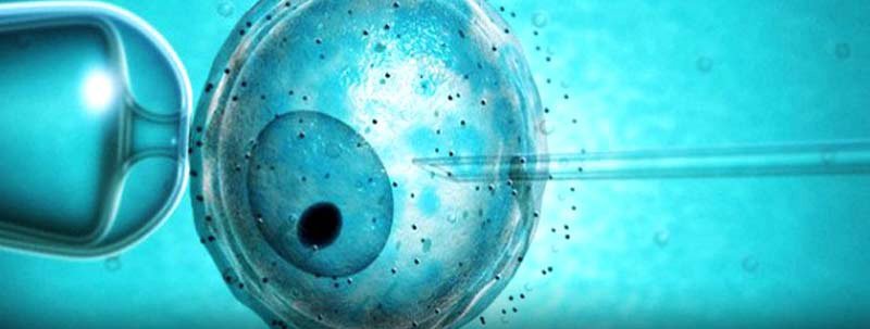 درمان ناباروری با آی وی اف (IVF)
