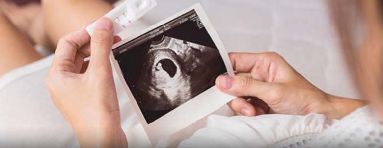 کاهش ذخیره تخمدان