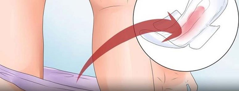 لکه بینی یا خونریزی در بارداری