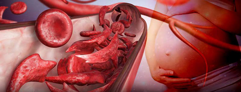 کم خونی در بارداری